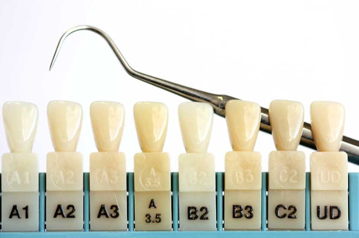 03nov teeth whiteners dental shade