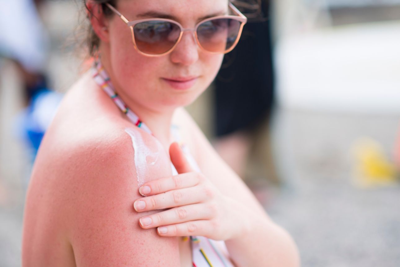 Woman applying sunscreen